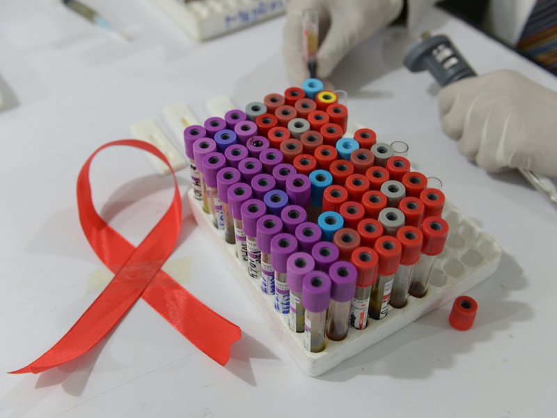 Aids-Ribbon-AFP