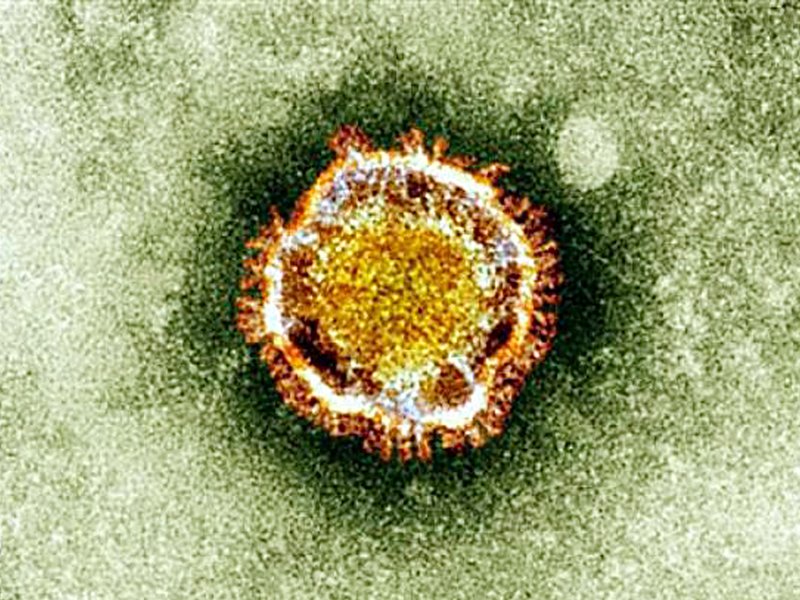 e Coronavirus seen under an electron miscroscope. France's first victim of a SARS-like virus