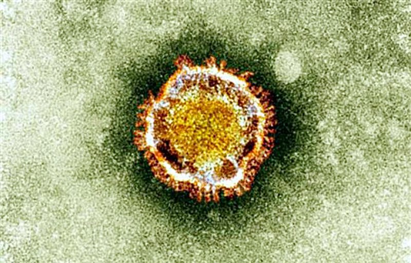 e Coronavirus seen under an electron miscroscope. France's first victim of a SARS-like virus