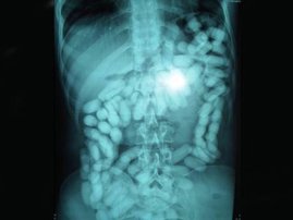 xray drugs