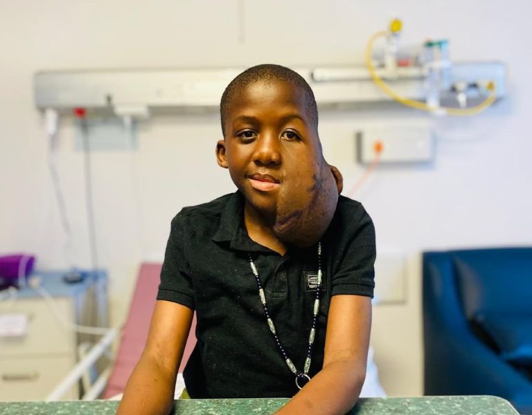Alondwe Ngwenya ready for surgery