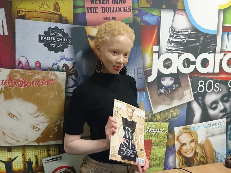 image thando hopa albino model