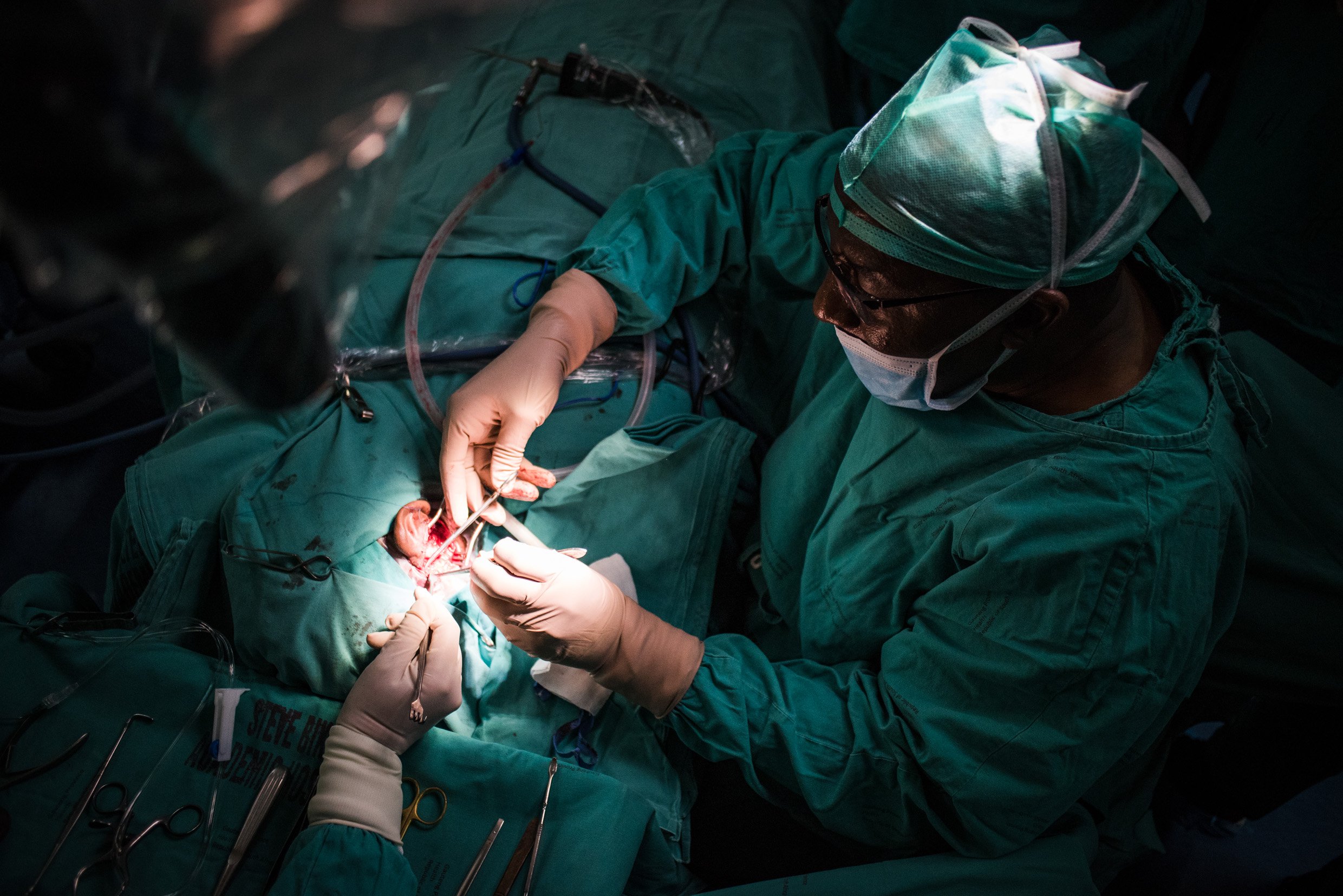 South Africa performs world's first successful middle ear transplant