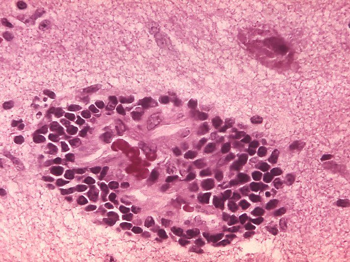 Rabies generics image