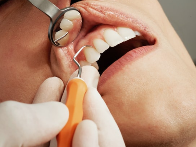 This Dentist was found guilty for deliberately damaging patients' teeth for profit...