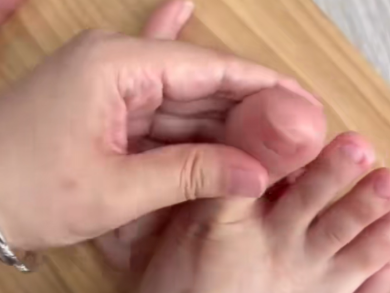 A woman places a silicone toe cap over her toe