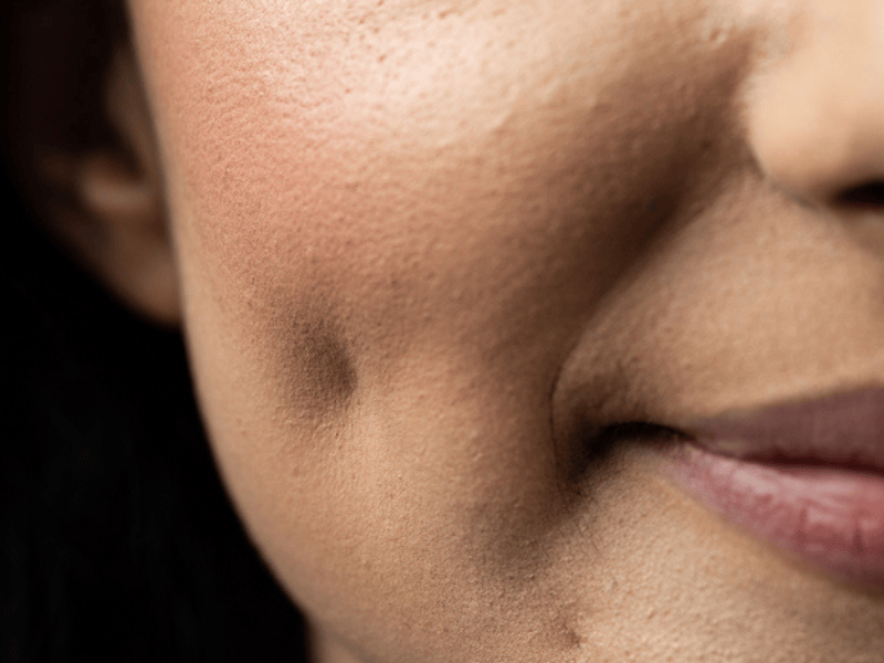 A woman with a dimple on her cheek