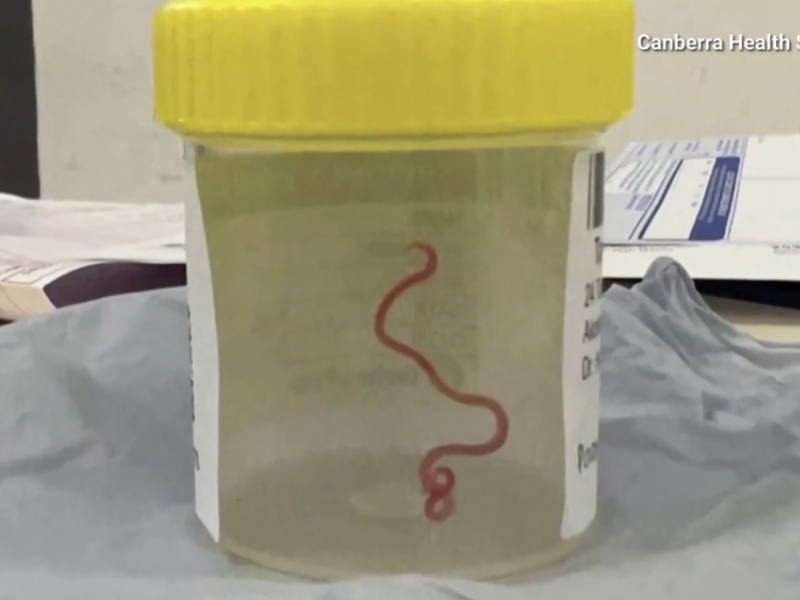 A worm inside a lab container at hospital