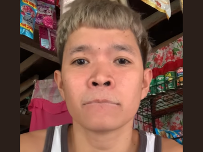 Prank Goes Wrong As Man Super Glues His Lips Together 