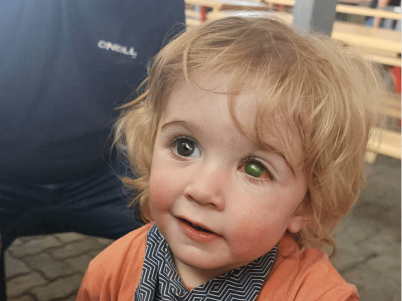 BOY_WITH_BLIND_EYE_JUWAAN