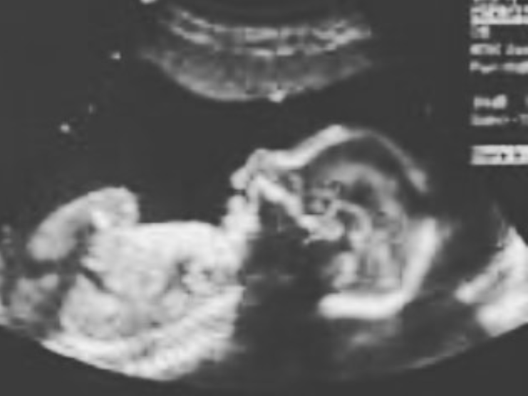 JSbu Baby Smanga Scan