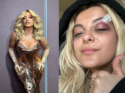 Bebe Rexha doing "good" after fan throws phone on stage