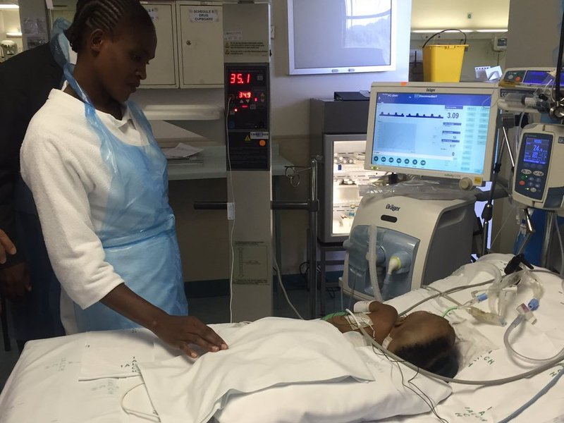 Separated conjoined twins Albert luthuli