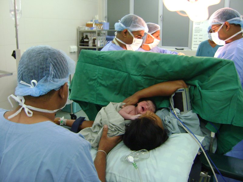 C-section birth