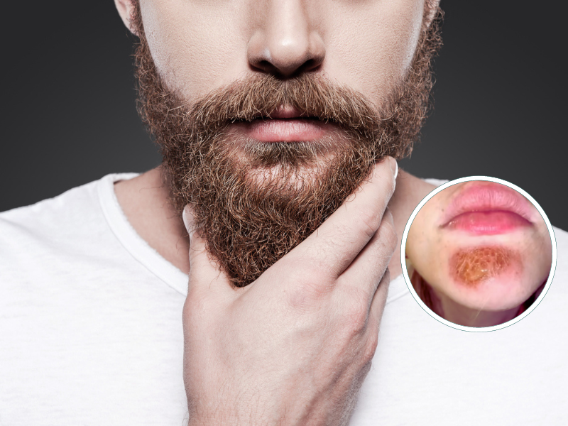 Close up of a man touching his brown beard