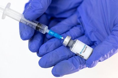 KZN confirms case of Mpox - Vimarsana News