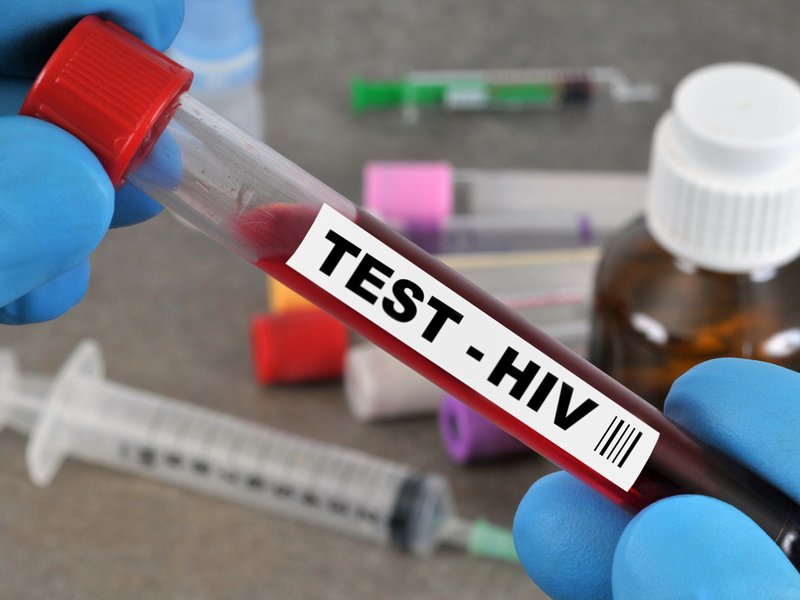 HIV test
