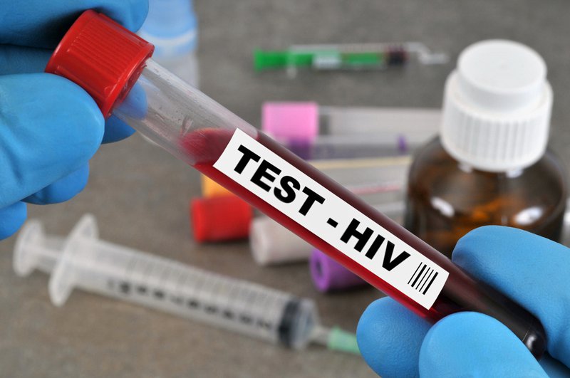 HIV test