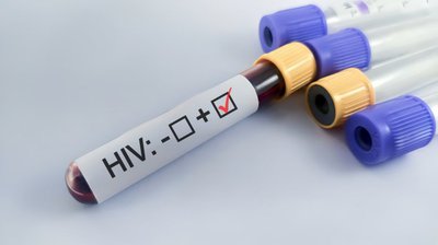 South Africa among first countries to introduce Lenacapavir HIV prevention injection