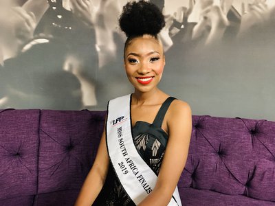 'I want to change the perception of beauty' - unique facial birthmark