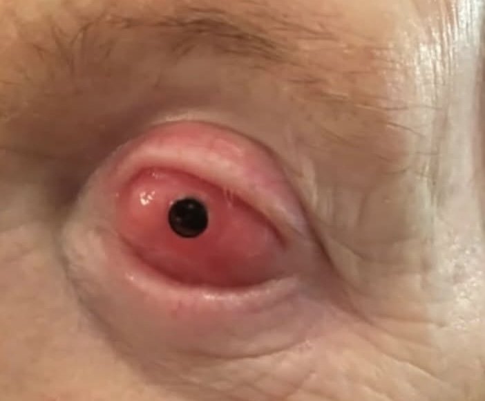 Gail Lane eye