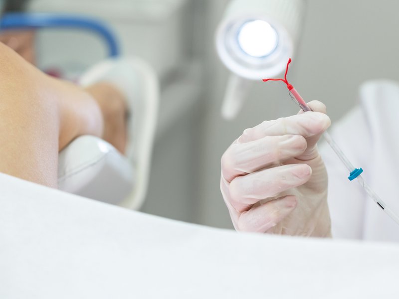 Women share horrific experiences of using IUD contraceptives