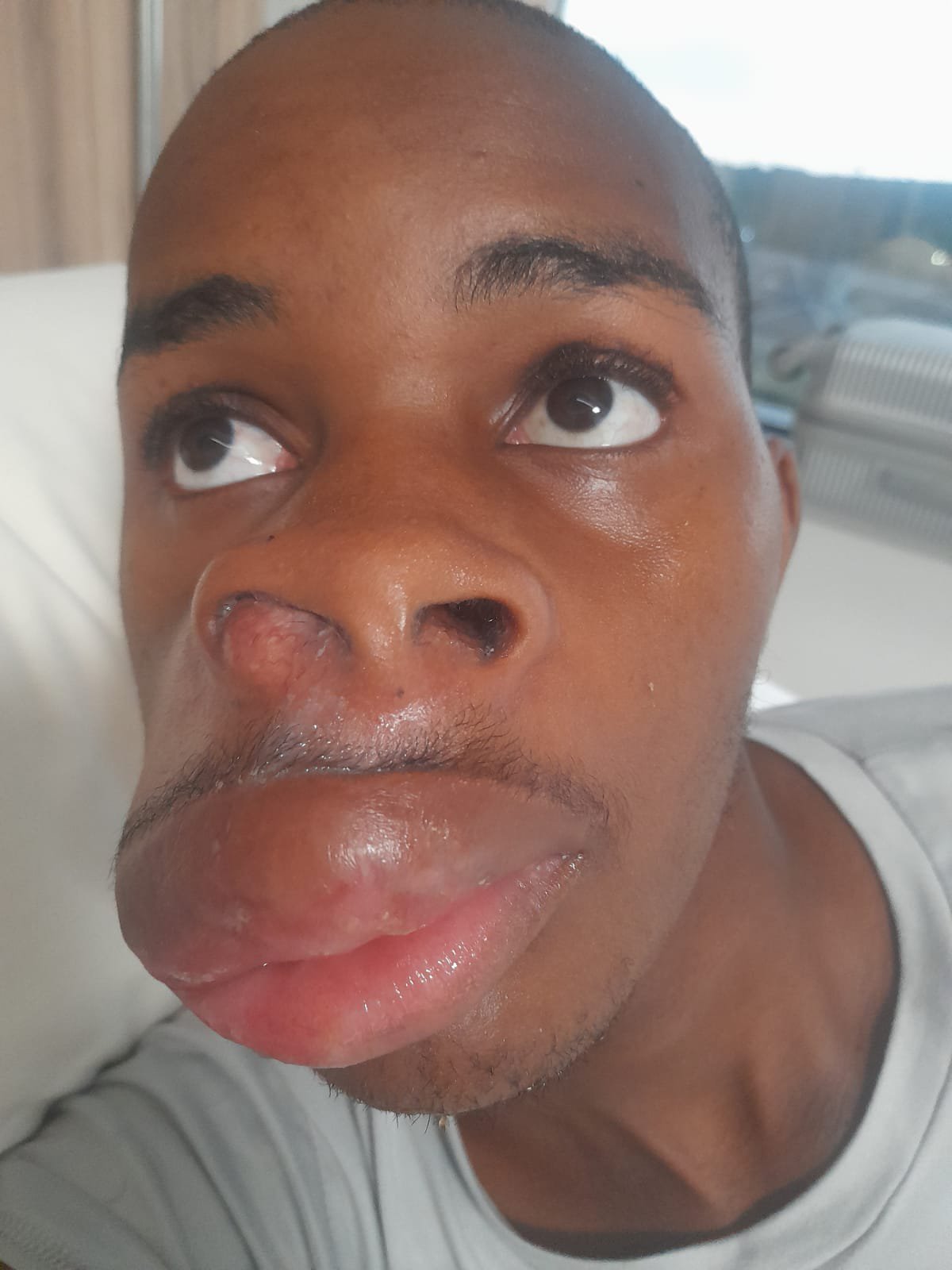 KAMOGELO GOOD MORNING ANGELS BEFORE SURGERY