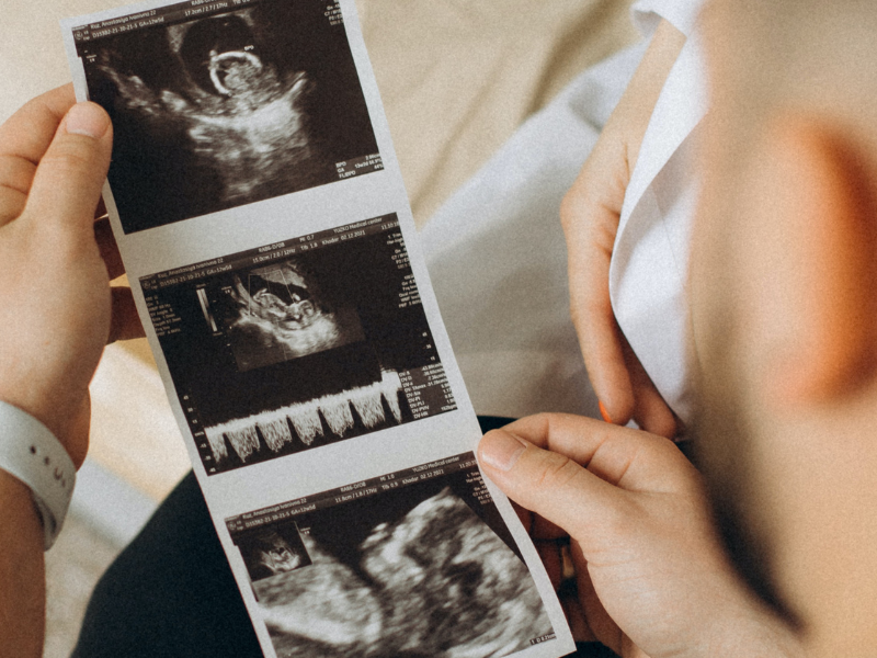 Man watching baby ultrasound scans