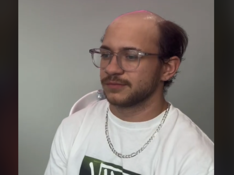 Man with bald head sits on a salon chair