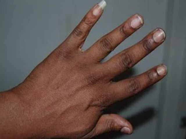 Long pinky nail