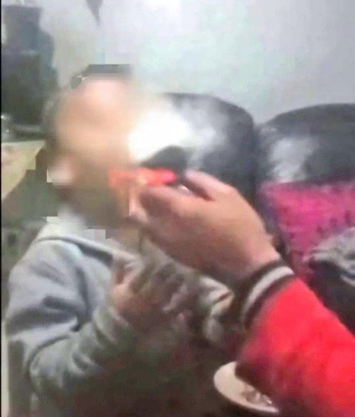 Minor smoking drugs