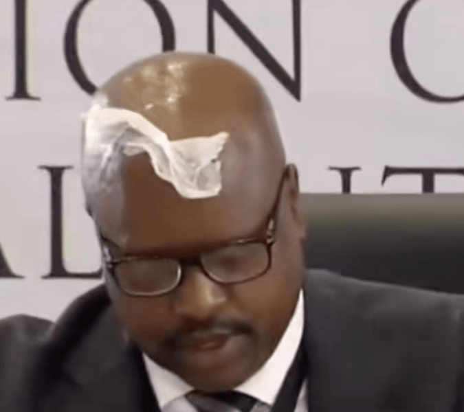 Paper Julius Mkhwanazi forehead