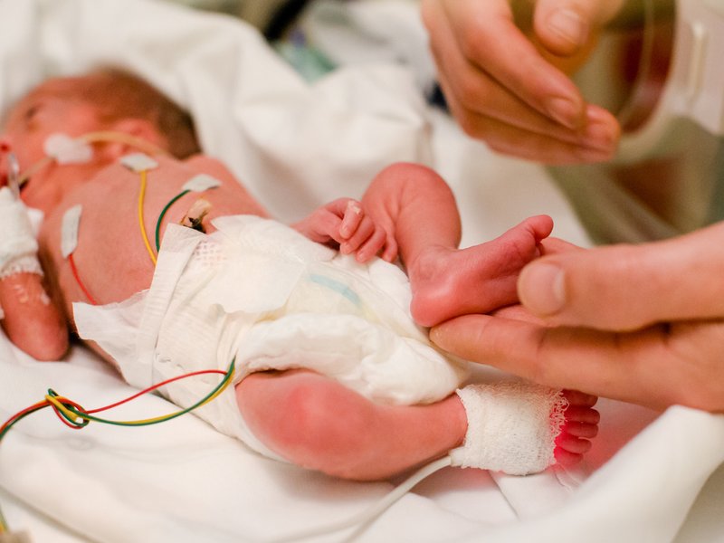 Premature baby