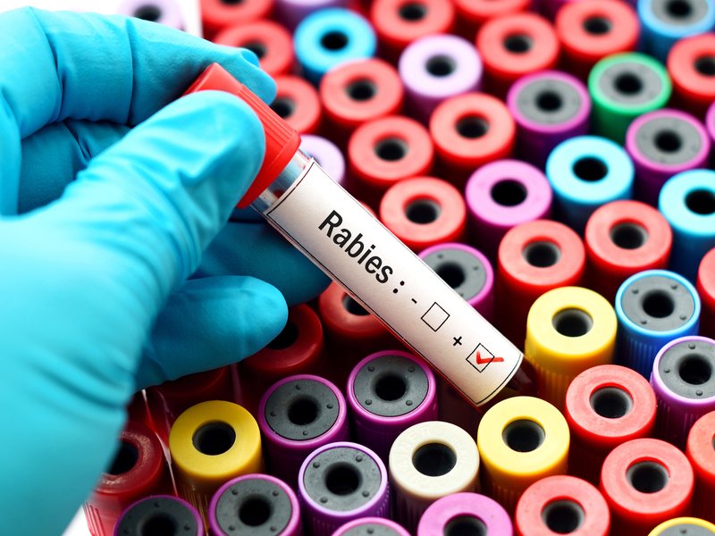 Rabies