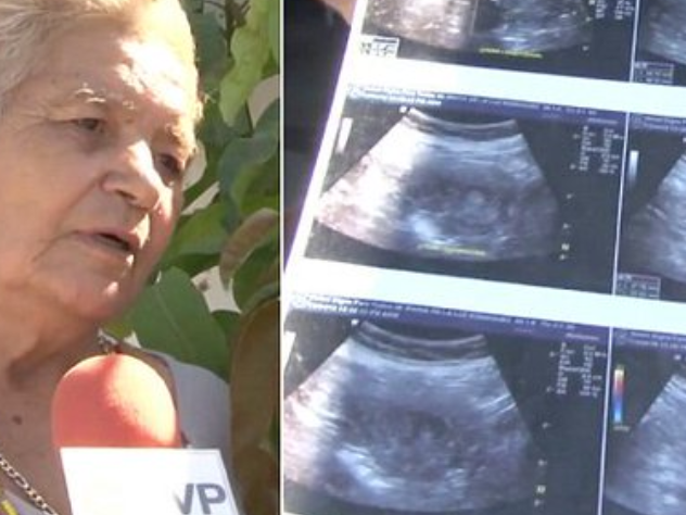 70 year old pregnant woman