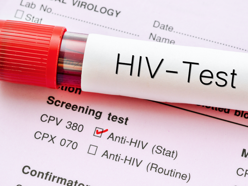 hiv testing / istock