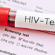 hiv testing / istock