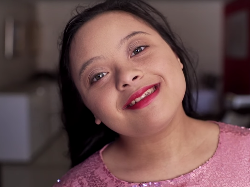 Down syndrome model