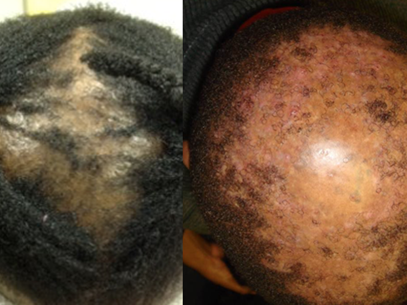 Both pics are of the same patient over a period of time