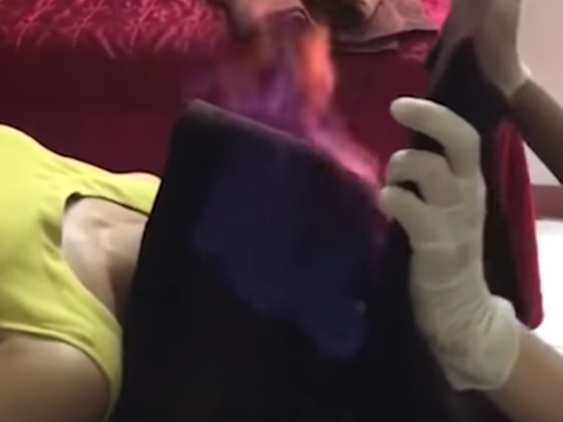 Crazy facial treatment involves using fire on the face / YouTube