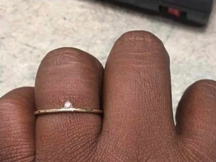 Woman's tiny engagement ring / Reddit