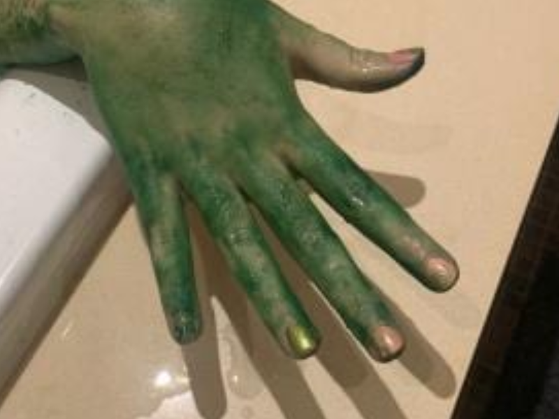Daughter turned green / https://www.news.com.au