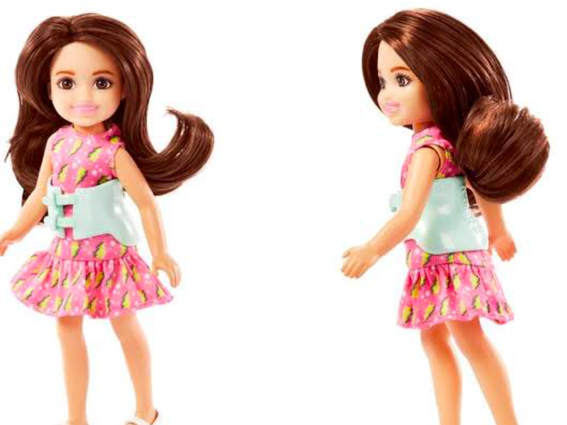 Scoliosis Barbie