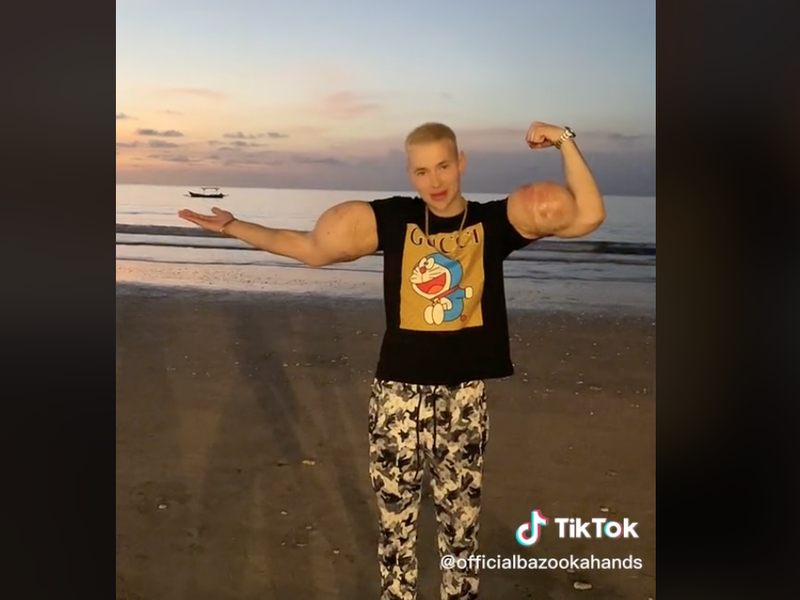 Man shows off strange arm muscle modification