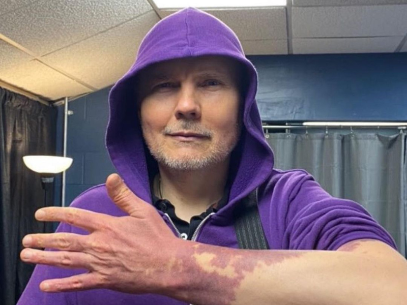 Smashing Pumpkins singer shows his ‘port wine’ birthmark after years of ...