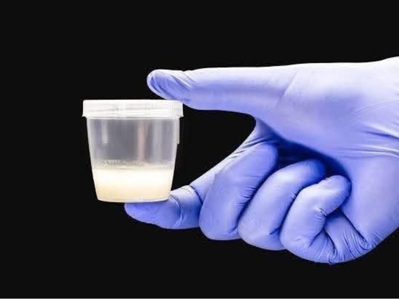 Sperm donate