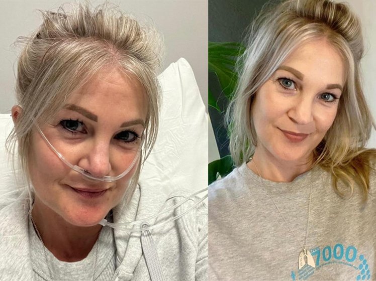 Tanya Bothma double lung recipient