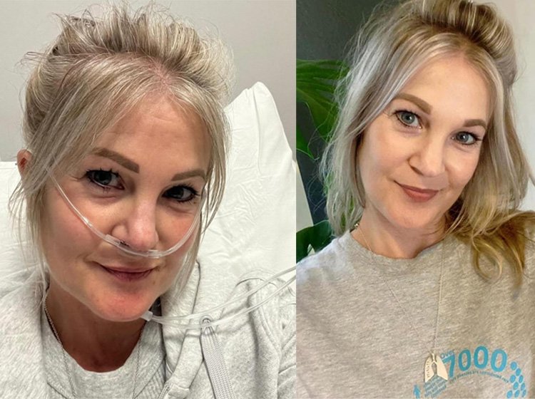 Tanya Bothma double lung recipient
