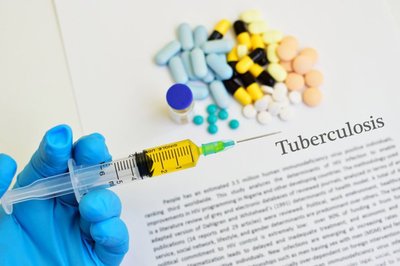 KZN researchers join global study on asymptomatic TB transmission
