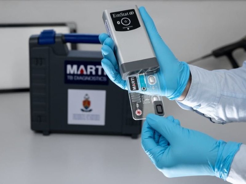 UP researchers innovate handheld detection device that could transform TB screening